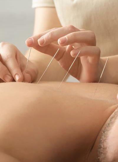 especialidade-acupuntura-foto1-400x550.jpg