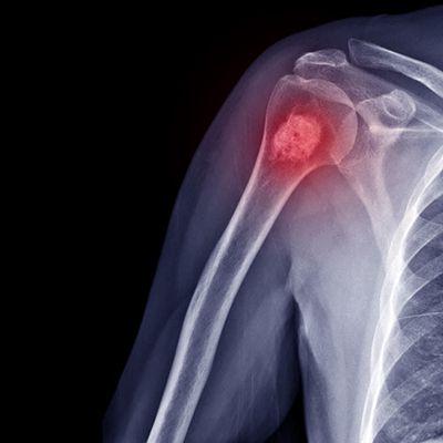 especialidade-oncologiaortopedica_400x400.jpg