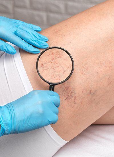 especialidade-vascular-foto1-400x550.jpg