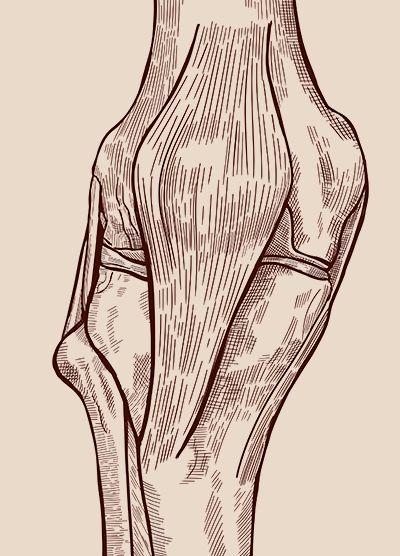 interna-cirurgia-joelho-400x556.jpg